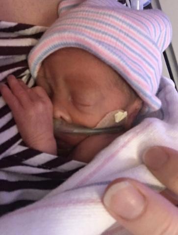 Premature baby Premature baby.
