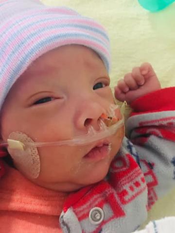 Premature baby.