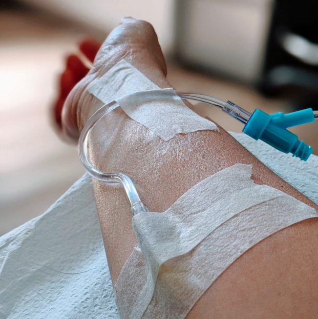 An arm with light skin with an IV needle attached and taped