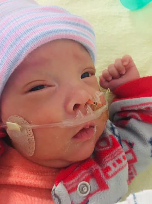 Premature baby.